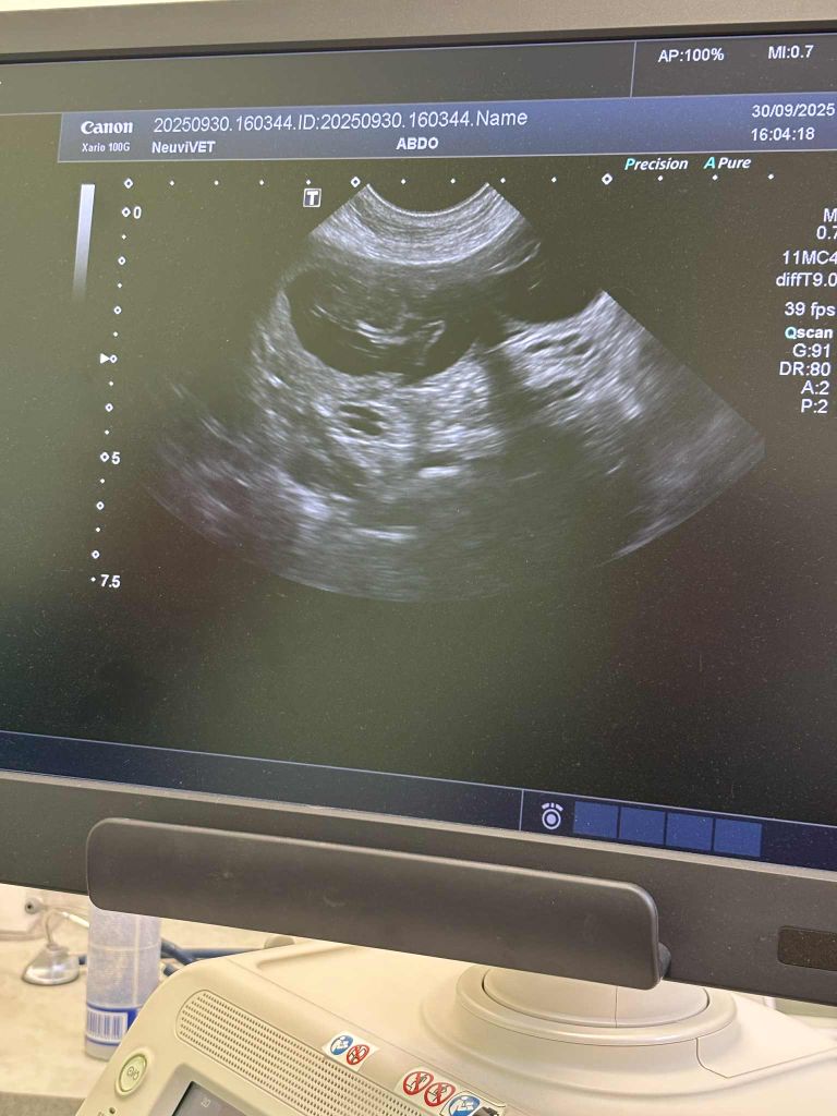 Gestation confirmee par échographie...!